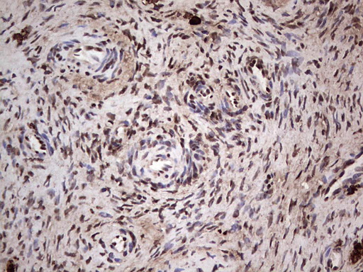 m04753 1 anti sae1 mouse monoclonal antibody clone id oti6b11 ihc testing 3