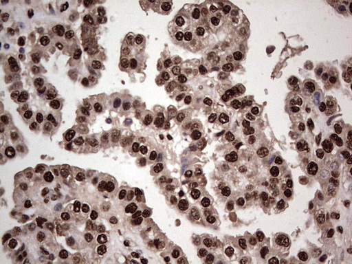 m04753 1 anti sae1 mouse monoclonal antibody clone id oti6b11 ihc testing 4