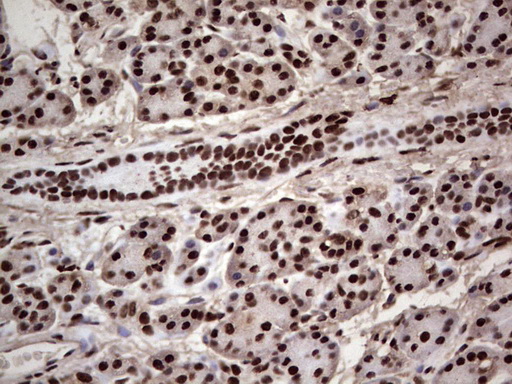 m04753 1 anti sae1 mouse monoclonal antibody clone id oti6b11 ihc testing 5