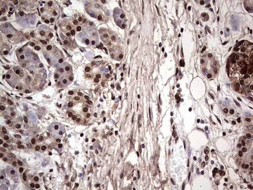 m04753 1 anti sae1 mouse monoclonal antibody clone id oti6b11 ihc testing 6
