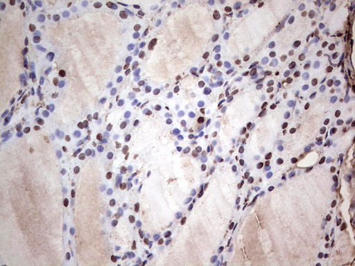 m04753 1 anti sae1 mouse monoclonal antibody clone id oti6b11 ihc testing 7