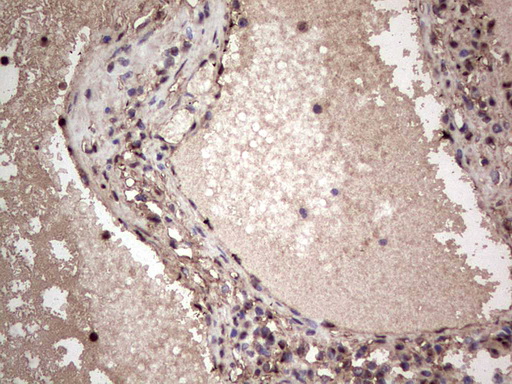 m04753 1 anti sae1 mouse monoclonal antibody clone id oti6b11 ihc testing 8