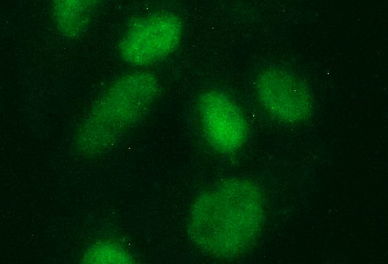 Immunofluorescent staining of HeLa cells using anti-SAE1 mouse monoclonal antibody (M04753)