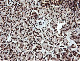 m04753 anti sae1 mouse monoclonal antibody clone id oti1g8 ihc testing 3