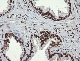 m04753 anti sae1 mouse monoclonal antibody clone id oti1g8 ihc testing 4