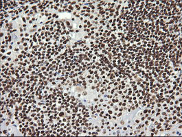 m04753 anti sae1 mouse monoclonal antibody clone id oti1g8 ihc testing 5