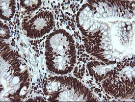 m04753 anti sae1 mouse monoclonal antibody clone id oti1g8 ihc testing 6