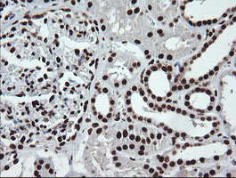 m04753 anti sae1 mouse monoclonal antibody clone id oti1g8 ihc testing 7