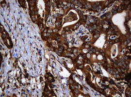 m04755 1 anti serbp1 mouse monoclonal antibody clone id oti2e11 ihc testing 10