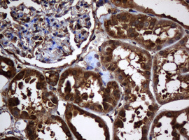 m04755 1 anti serbp1 mouse monoclonal antibody clone id oti2e11 ihc testing 9