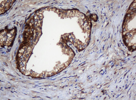 m04755 anti serbp1 mouse monoclonal antibody clone id oti5g2 ihc testing 10