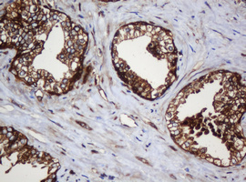 m04755 anti serbp1 mouse monoclonal antibody clone id oti5g2 ihc testing 12