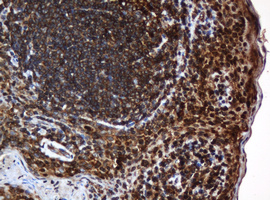 m04755 anti serbp1 mouse monoclonal antibody clone id oti5g2 ihc testing 13