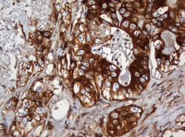 m04755 anti serbp1 mouse monoclonal antibody clone id oti5g2 ihc testing 14