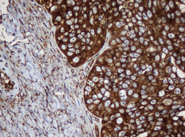m04755 anti serbp1 mouse monoclonal antibody clone id oti5g2 ihc testing 3