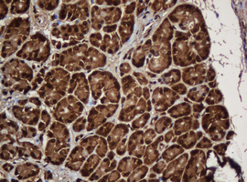 m04755 anti serbp1 mouse monoclonal antibody clone id oti5g2 ihc testing 4