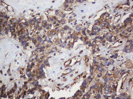 m04755 anti serbp1 mouse monoclonal antibody clone id oti5g2 ihc testing 5