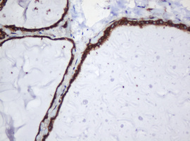 m04755 anti serbp1 mouse monoclonal antibody clone id oti5g2 ihc testing 6