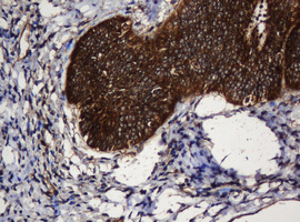 m04755 anti serbp1 mouse monoclonal antibody clone id oti5g2 ihc testing 8