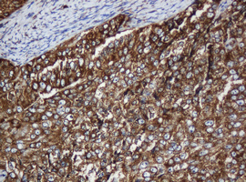 m04755 anti serbp1 mouse monoclonal antibody clone id oti5g2 ihc testing 9
