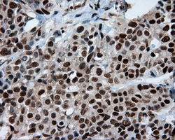 m04766 1 anti sil1 mouse monoclonal antibody clone id oti1f9 ihc testing 10