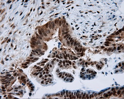 m04766 1 anti sil1 mouse monoclonal antibody clone id oti1f9 ihc testing 11