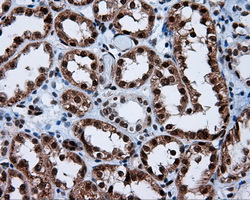 m04766 1 anti sil1 mouse monoclonal antibody clone id oti1f9 ihc testing 12