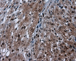 m04766 1 anti sil1 mouse monoclonal antibody clone id oti1f9 ihc testing 13