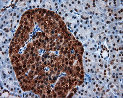 m04766 1 anti sil1 mouse monoclonal antibody clone id oti1f9 ihc testing 4