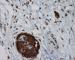 m04766 1 anti sil1 mouse monoclonal antibody clone id oti1f9 ihc testing 5