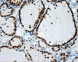m04766 1 anti sil1 mouse monoclonal antibody clone id oti1f9 ihc testing 6