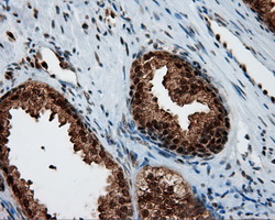 m04766 1 anti sil1 mouse monoclonal antibody clone id oti1f9 ihc testing 7