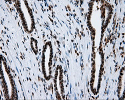 m04766 1 anti sil1 mouse monoclonal antibody clone id oti1f9 ihc testing 9