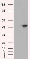HEK293T cells were transfected with the pCMV6-ENTRY control (Left lane) or pCMV6-ENTRY SIL1 (Right lane) cDNA for 48 hrs and lysed