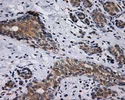 m04766 anti sil1 mouse monoclonal antibody clone id oti3b11 ihc testing 4