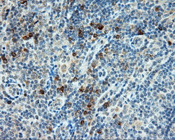 m04766 anti sil1 mouse monoclonal antibody clone id oti3b11 ihc testing 5