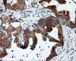 m04766 anti sil1 mouse monoclonal antibody clone id oti3b11 ihc testing 6