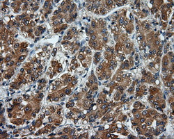 m04766 anti sil1 mouse monoclonal antibody clone id oti3b11 ihc testing 7