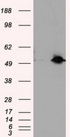 HEK293T cells were transfected with the pCMV6-ENTRY control (Left lane) or pCMV6-ENTRY SIL1 (Right lane) cDNA for 48 hrs and lysed