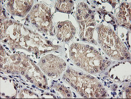 Immunohistochemical staining of paraffin-embedded Human Kidney tissue within the normal limits using anti-RAMP2 mouse monoclonal antibody