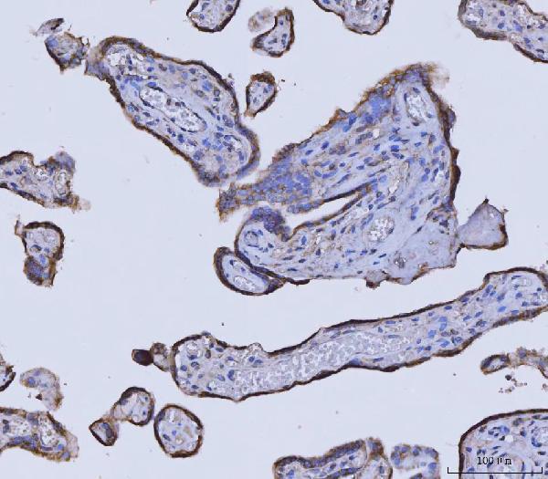  IHC analysis of GLDC using anti-GLDC antibody (M04777)
