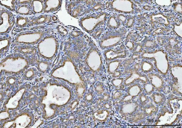 IHC analysis of GLDC using anti-GLDC antibody (M04777)