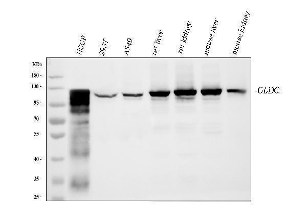  Western blot analysis of GLDC using anti-GLDC antibody (M04777)