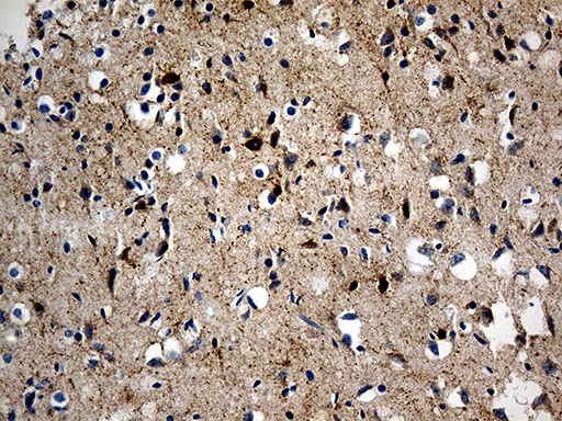 m04779 anti chromogranin c scg2 mouse monoclonal antibody clone id oti3f12 ihc testing 2