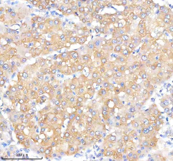  IHC analysis of IQGAP2 using anti-IQGAP2 antibody (M04787)