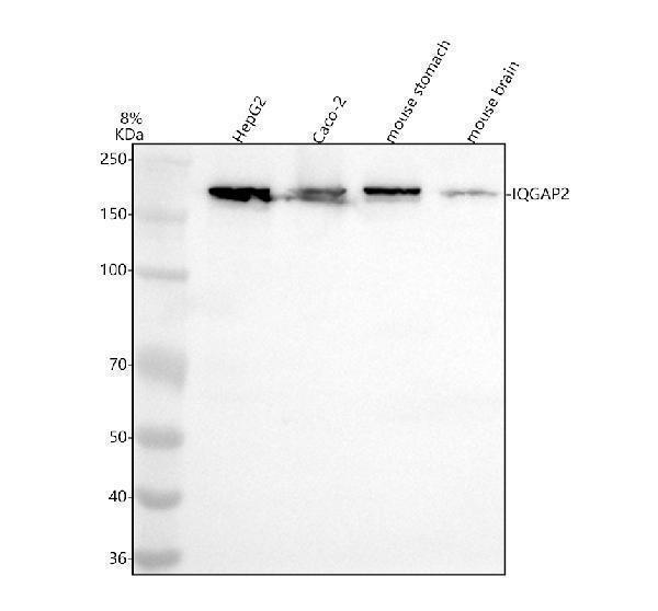  Western blot analysis of IQGAP2 using anti-IQGAP2 antibody (M04787)