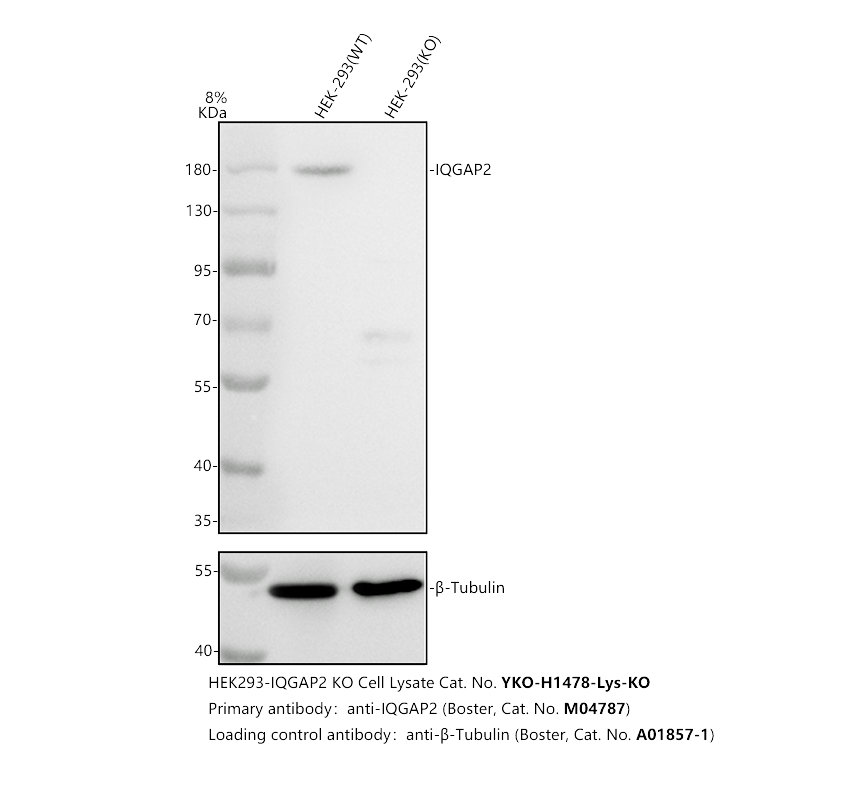Western blot analysis of IQGAP2 using anti-IQGAP2 antibody (M04787)