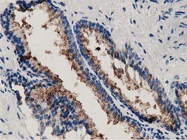 Immunohistochemical staining of paraffin-embedded Human prostate tissue within the normal limits using anti-ANXA3 mouse monoclonal antibody