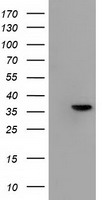 HEK293T cells were transfected with the pCMV6-ENTRY control (Left lane) or pCMV6-ENTRY ANXA3 (Right lane) cDNA for 48 hrs and lysed