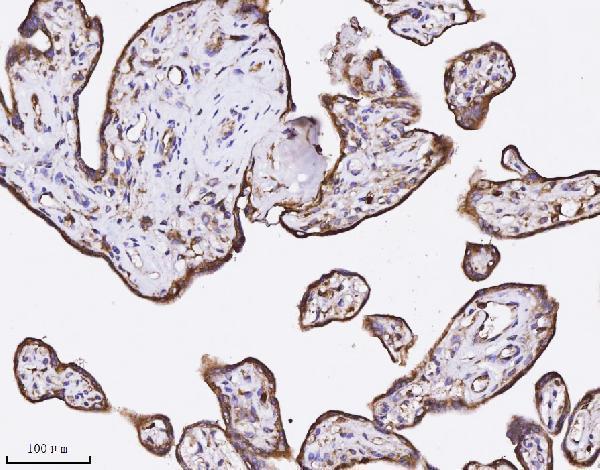  IHC analysis of Annexin A3 using anti-Annexin A3 antibody (M04796-2)